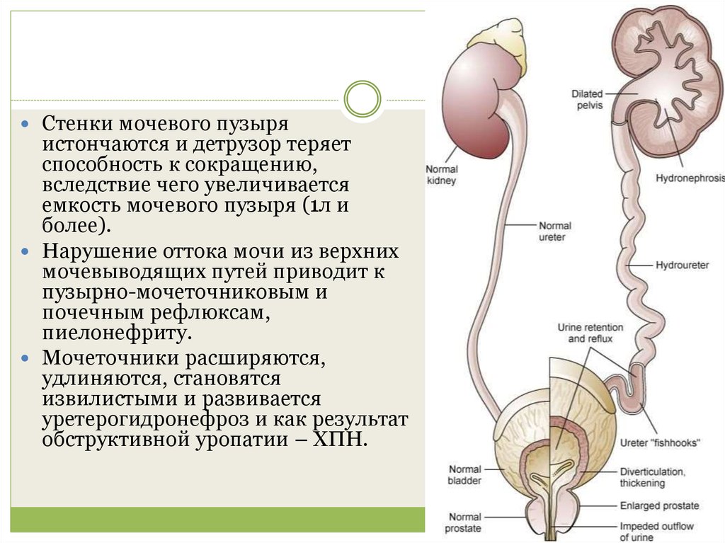 Нарушение стенки. Средство для повышения тонуса детрузора мочевого пузыря. Стенкеии мочевого пузыря. Детрузор мочевого пузыря это.