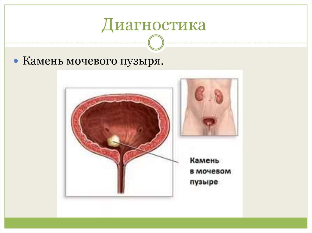 Диагностика