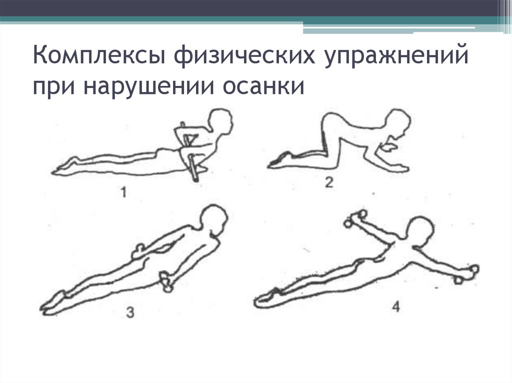 Комплекс для осанки. Гимнастика для спины при нарушении осанки. ЛФК при нарушении осанки упражнения. Комплекс упражнений гимнастики при нарушении осанки. Упражнения при нарушении осанки у детей.