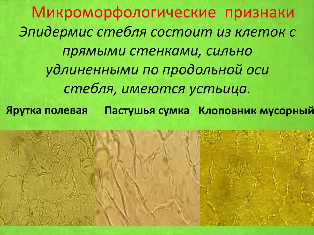 Эпидермис стебля состоит из клеток с прямыми стенками, сильно удлиненными по продольной оси стебля, имеются устьица.