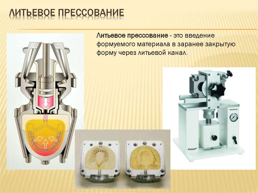 Способы изготовления пластмассы. Метод литьевого прессования пластмасс в стоматологии. Метод компрессионного прессования пластмасс. Технология изготовления протезов методом литьевого прессования.