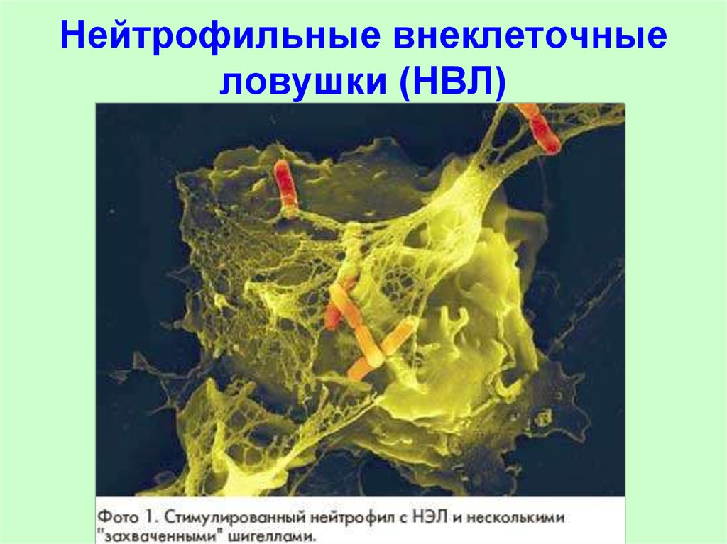 Все внеклеточные организмы. Нейтрофильные экстрацеллюлярные ловушки. Внеклеточные ловушки нейтрофилов (net). Экстрацеллюлярные нейтрофильные сети. Нейтрофильные внеклеточные ловушки сибергрин.