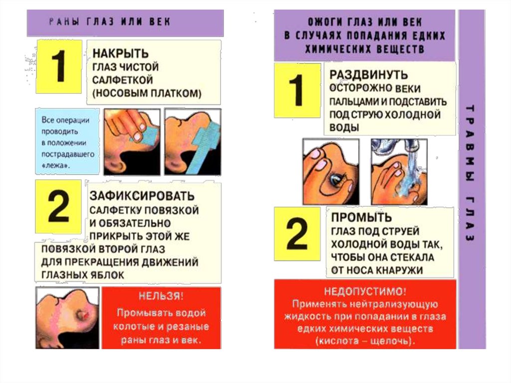 Памятка по оказанию первой помощи при несчастных случаях. Поеметка при попадании. Действия при попадании едких химических веществ в глаза.