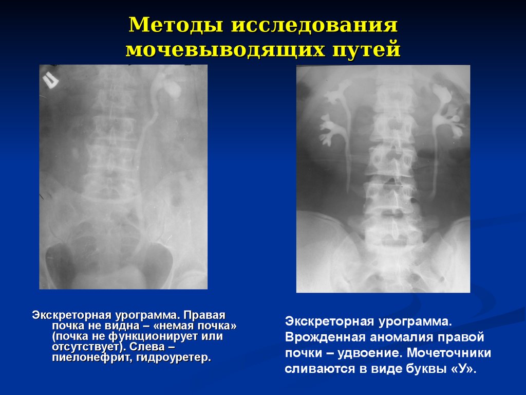 Прямое увеличение изображения достигается путем