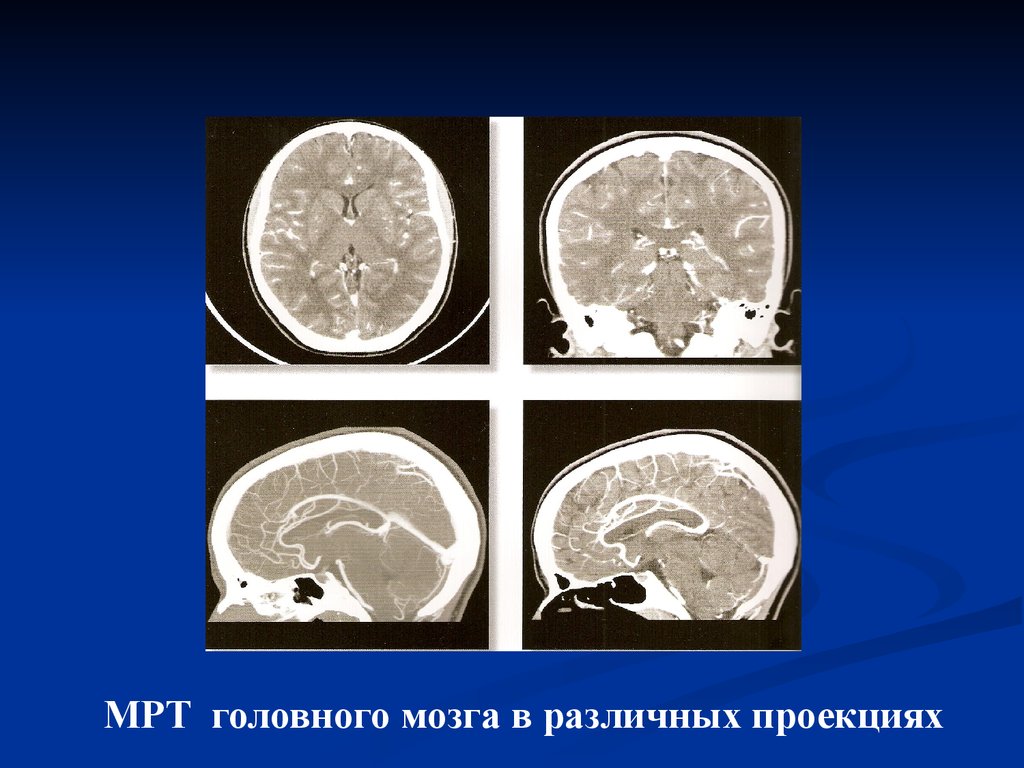 Мрт головного мозга с проекцией. Мрт головы с контрастом. Контрастные вещества в рентгенологии. Классификация контрастных веществ в рентгенологии.