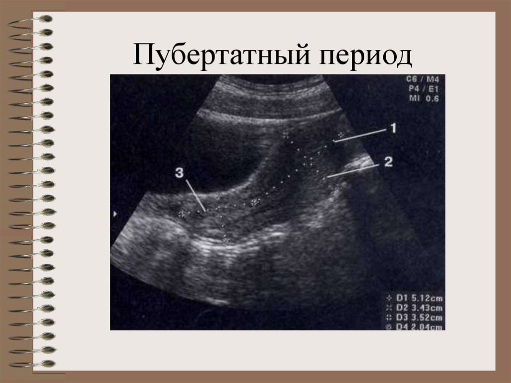 Детская гинекология презентация