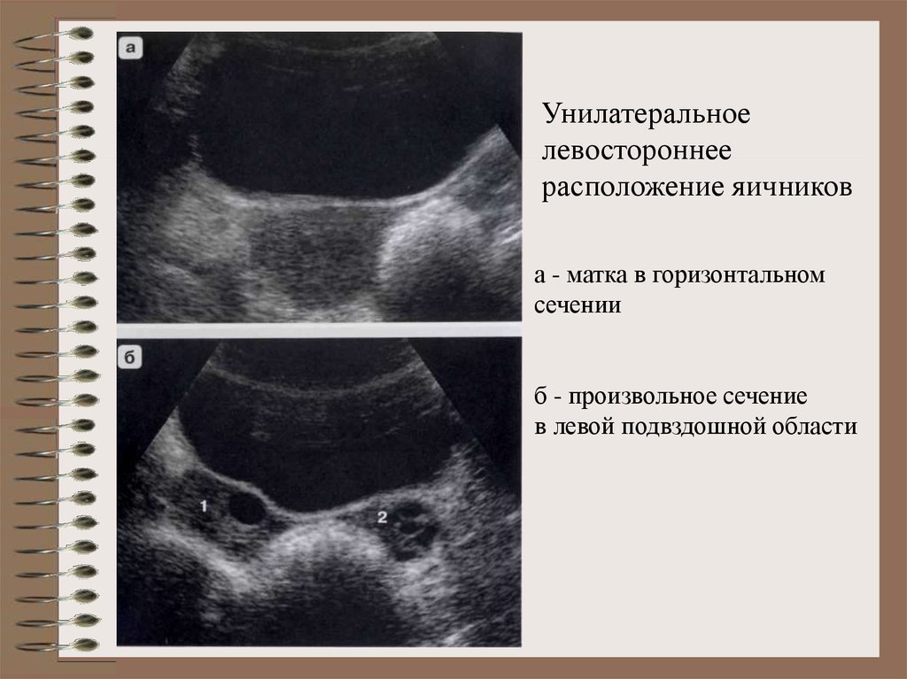 Детская гинекология презентация