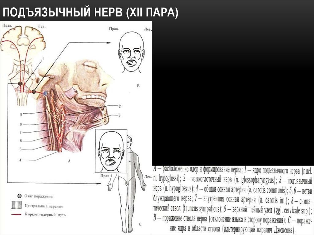 Подъязычный нерв. XII пара - подъязычный нерв. Подъязычный нерв схема неврология. Двенадцатая пара подъязычный нерв. Подъязычный нерв анатомия схема.