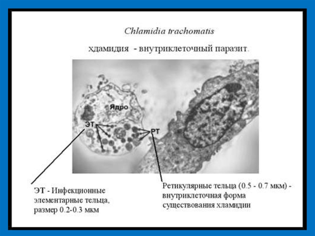 Элементарные тельца хламидий. Урогенитальный хламидиоз антигенная структура. Хламидия строение микробиология. Chlamydia trachomatis строение. Хламидии схема строения.