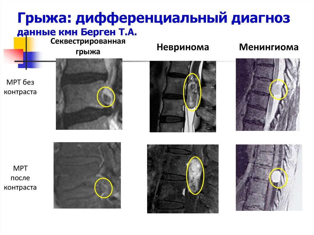 Мрт дифференциальная диагностика