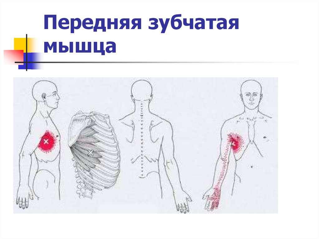 Передняя зубчатая мышца. Передняя зубчатая мышца триггерные точки. Синдром передней зубчатой мышцы. Передняя зубчатая мышца болит. Передняя зубчатая мышца кровоснабжение.