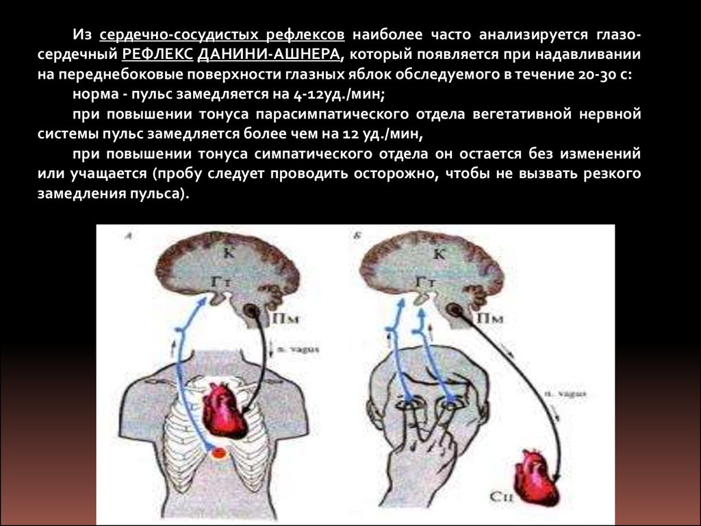 Схема глазосердечного рефлекса