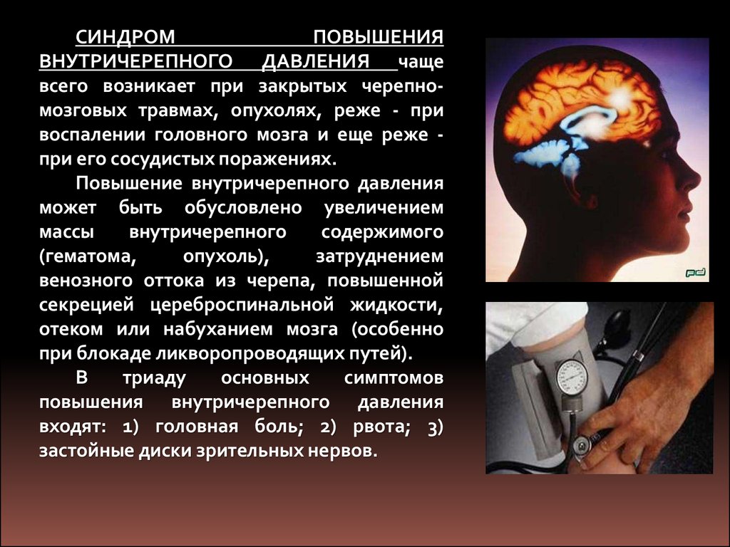 В формировании клинической картины синдрома авеллиса участвует черепной нерв