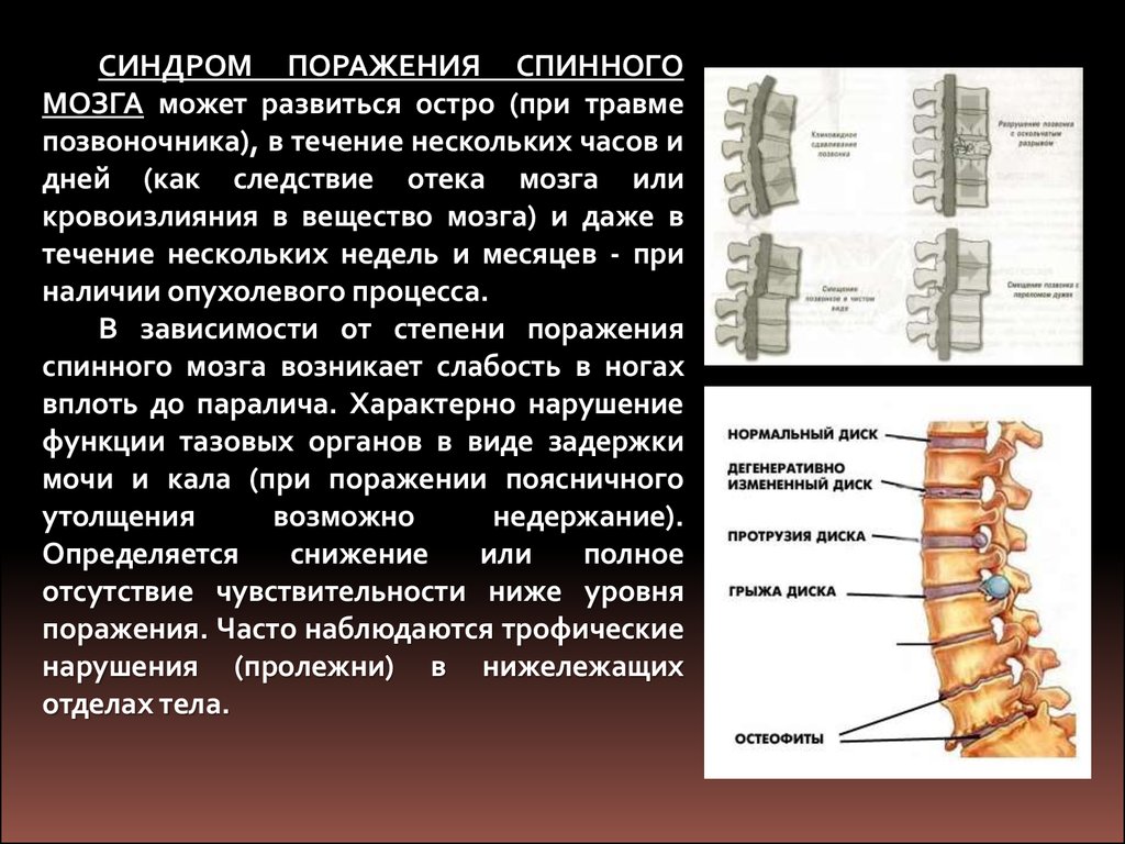 Травмы позвоночника с повреждением. Симптомы поражения шейного отдела спинного мозга. Повреждение спинного мозга в поясничном отделе. Травма поясничного отдела спинного мозга. Перелом спинного мозга симптомы.