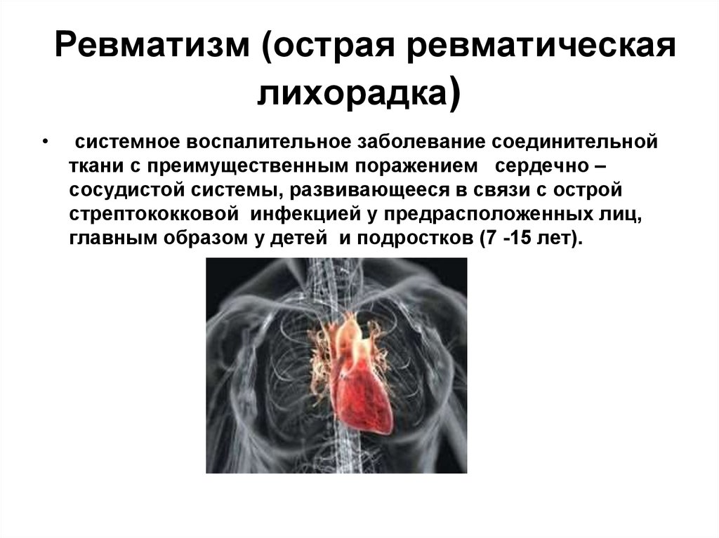 Клиническая картина ревматической лихорадки