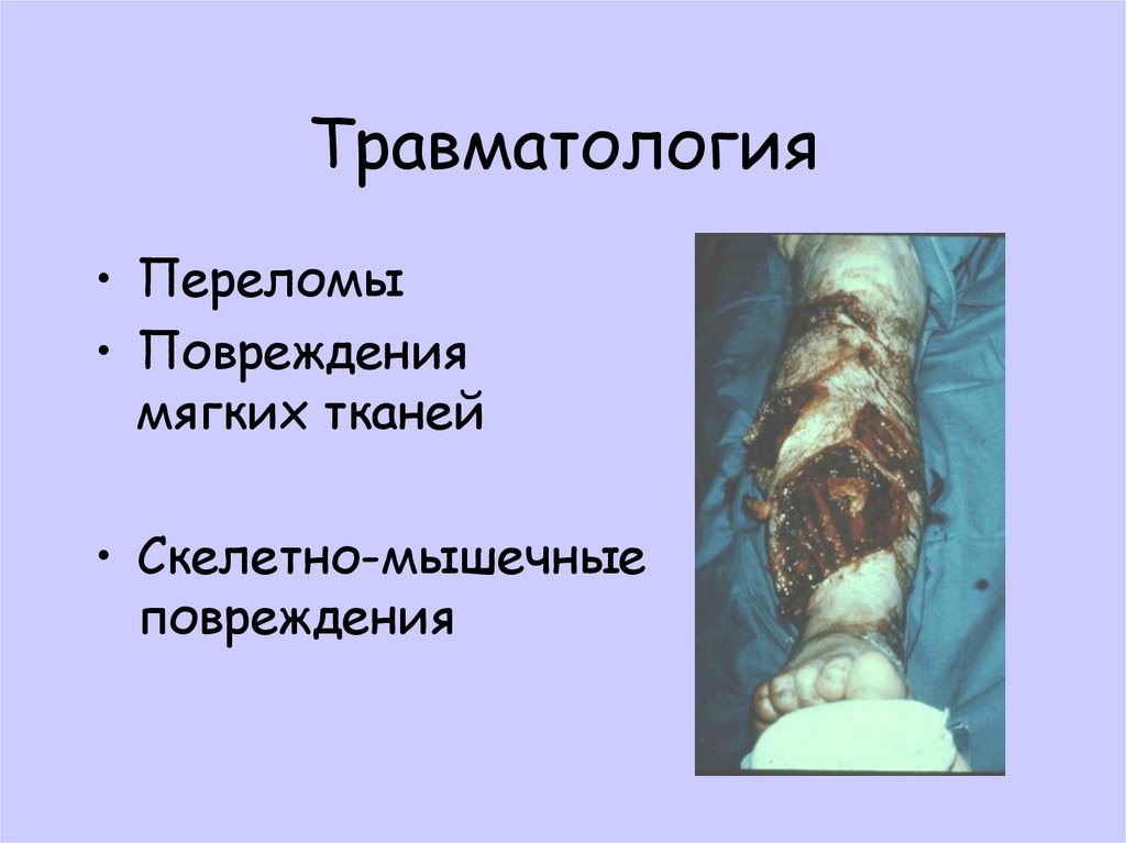 Травматология