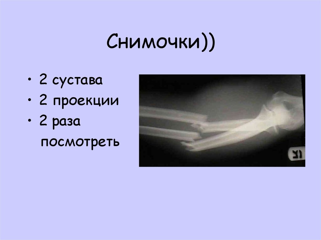 2 сустава. Травмы мягких тканей у кошек.