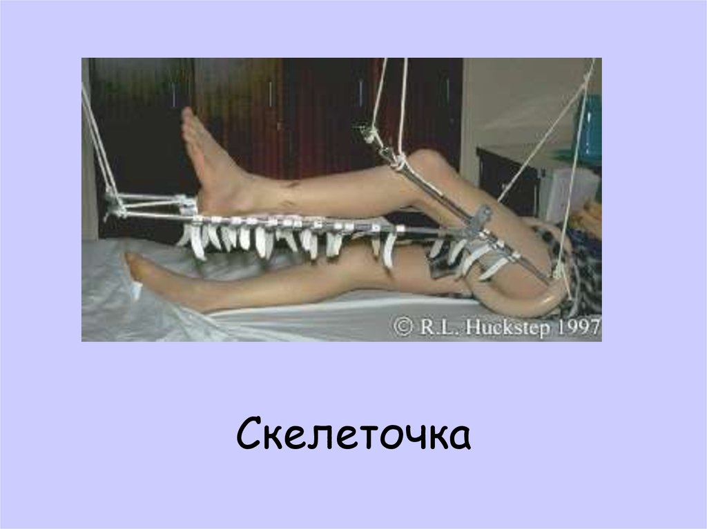 Скелеточка