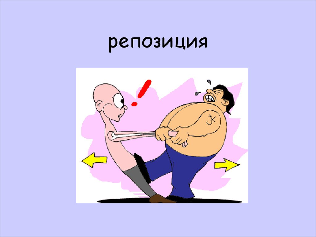 репозиция