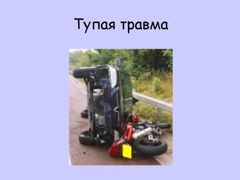 Тупая травма