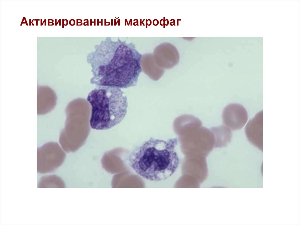 Активация макрофагов. Макрофаги м1 и м2. Активированный Макрофаг продуцирует. Синдром активации макрофагов.