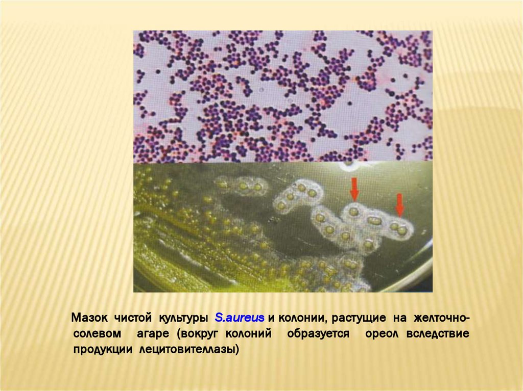 Стафилококк соскоб. Чистая культура стафилококка ауреус. Стафилококк ауреус мазок. Мазок чистой культуры s aureus. Условно патогенные стафилококки.