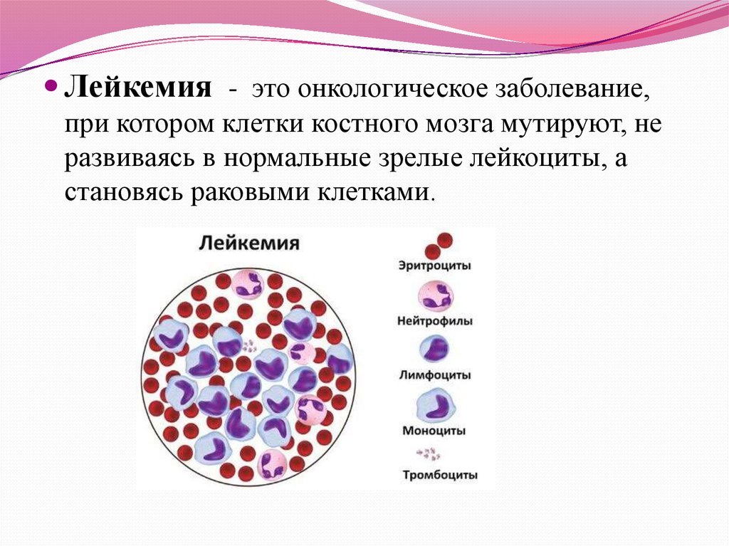 Лейкемией называется. Клетки костного мозга. Онкологические заболевания костного мозга.