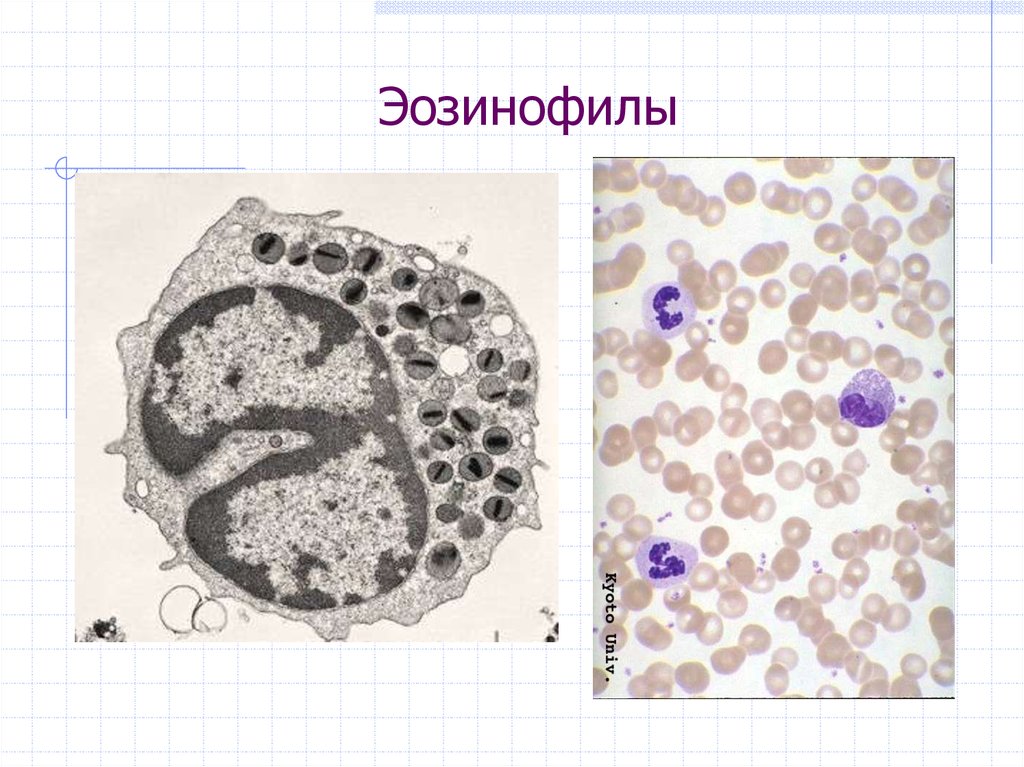 Эозинофилы это. Строение эозинофильных лейкоцитов. Эозинофилы строение клетки. Эозинофильный лейкоцит строение. Эозинофил Электронограмма.