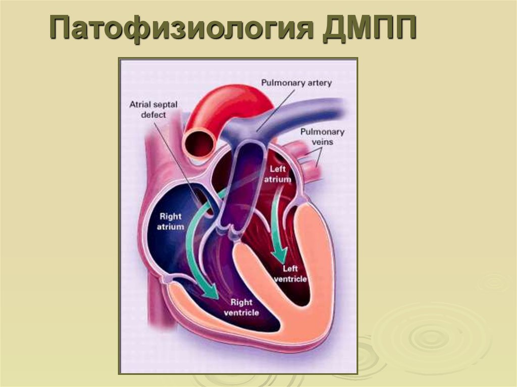 Дмпп у детей презентация