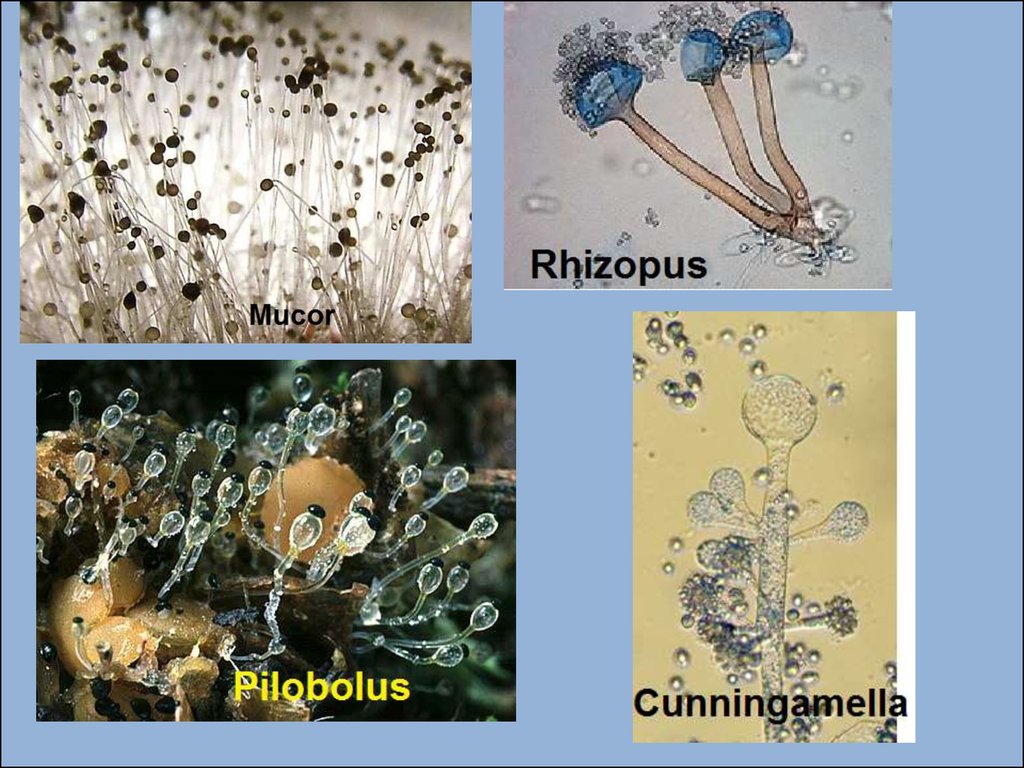 Споры низших грибов. Плесневые грибы ризопус. Мукор базидиомицет. Мукор ризопус. Низшие грибы мукор.