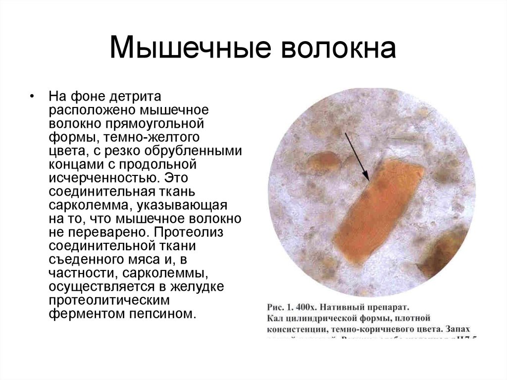 Соединительная ткань кал. Микроскопия кала мышечные волокна. Микроскопическое исследование кала детрит. Микроскопия кала растительная клетчатка непереваримая. Переваримые мышечные волокна в Кале.