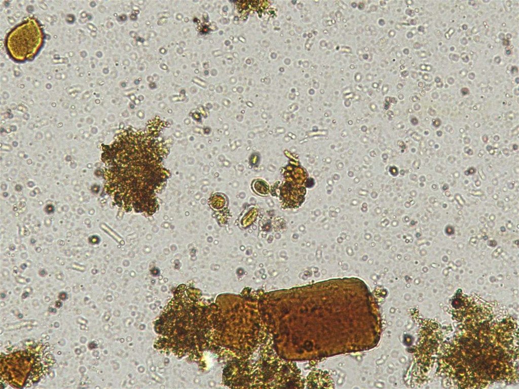 Бактерии в копрограмме. Мышечные волокна в Кале микроскопия. Копрология кала микроскопия. Микроскопия кала эритроциты. Микроскопия кала копрограмма.