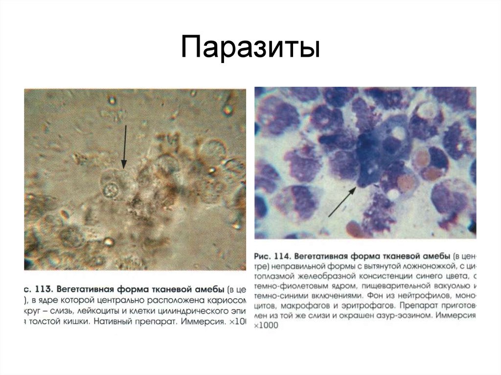 Микроскопия анализа кала