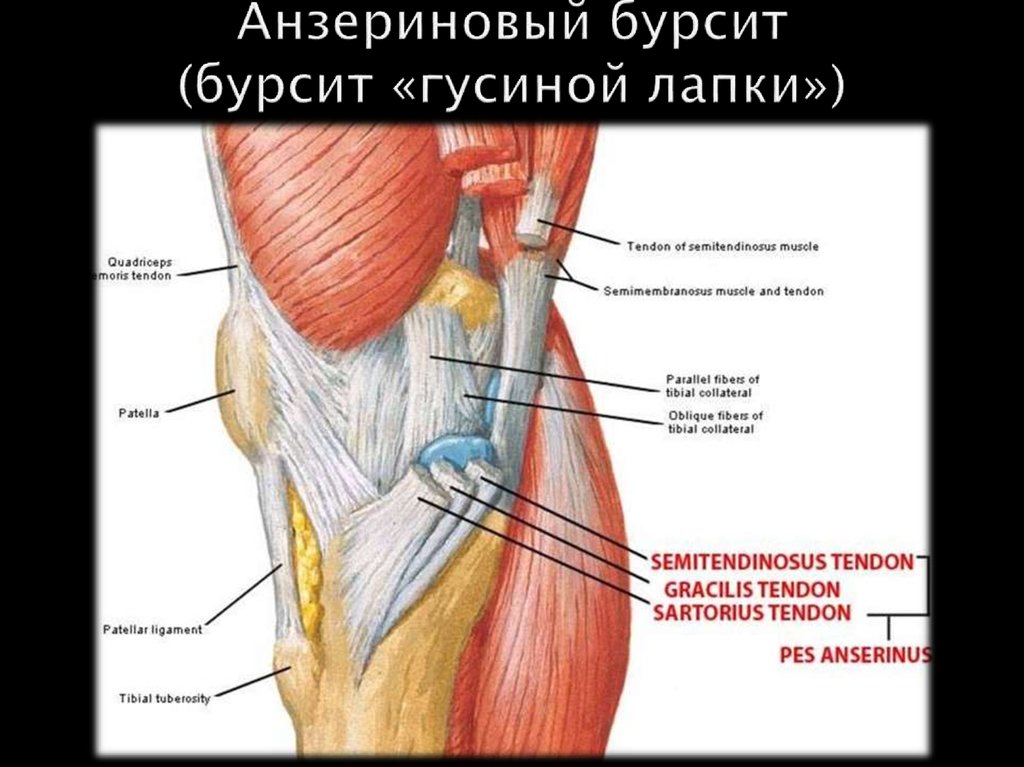 Подколенное сухожилие фото