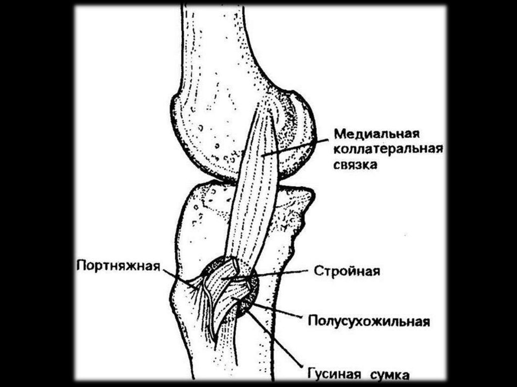 Синдром лапки. Поверхностная гусиная лапка коленного сустава анатомия. Гусиная лапка коленного сустава анатомия. Гусиная лапка сухожилия коленного сустава. Сухожилия гусиной лапки коленного сустава анатомия.