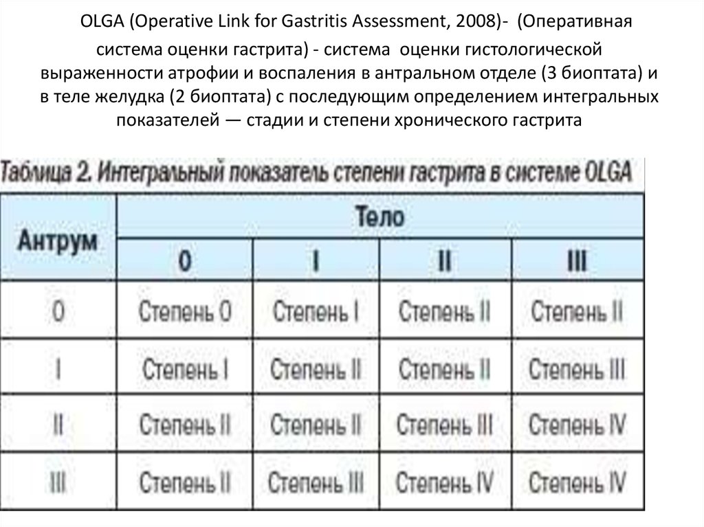 Степени активности хронического гастрита. Olga классификация хронического гастрита. Гастрит Olga 2 стадия 2 степень. Классификация Olga 2 стадия 2 степень. Классификация Olga.