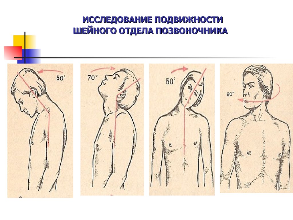 Тест позвоночник. Движения в шейном отделе. Исследование подвижности позвоночника. Подвижность шейного отдела позвоночника. Исследование подвижности шейного отдела позвоночника.