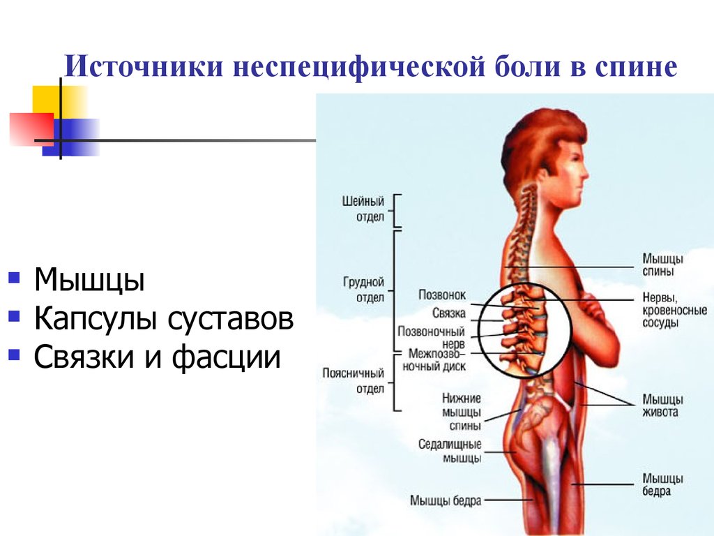 Боль в спине презентация