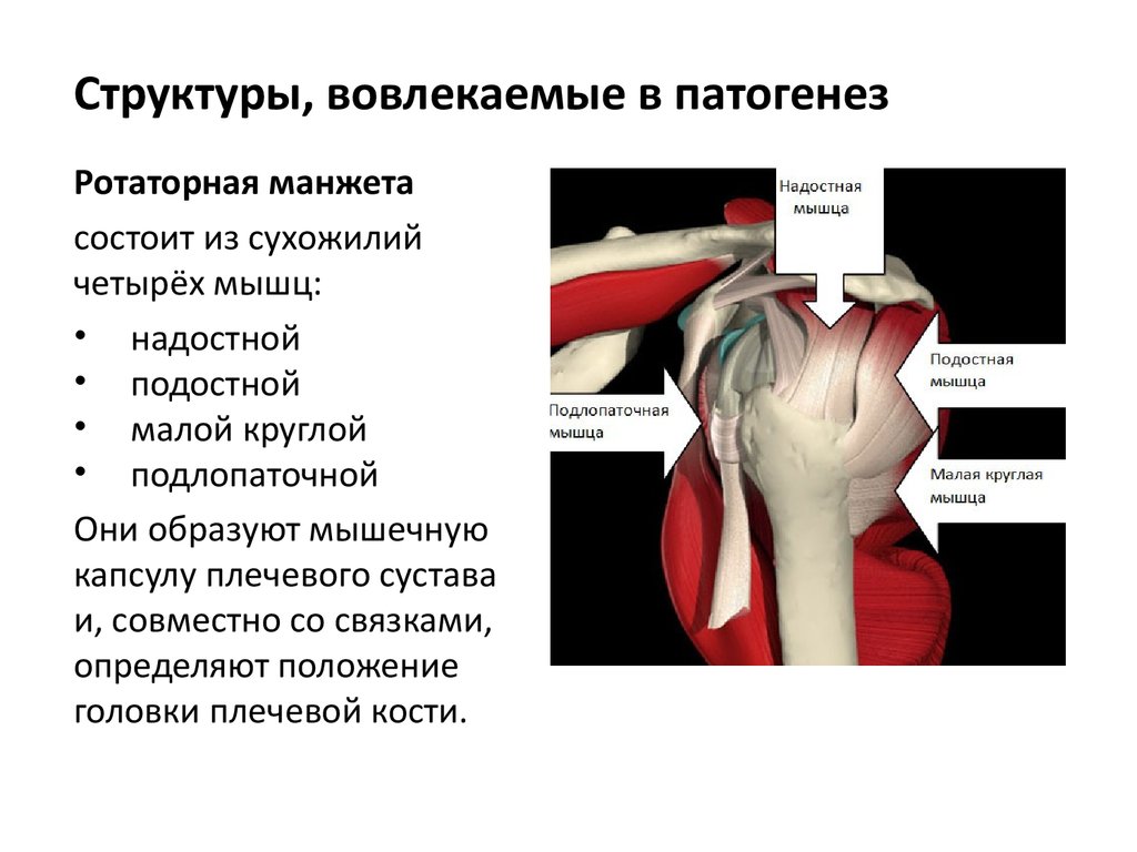 Разрыв надостного сухожилия плечевого сустава лечение. Ротаторная манжета плечевого сустава надостная. Тендинопатия сухожилия плечевого сустава. Тендиноз сухожилия надостной мышцы мрт. Тендинит подостная мышца плечевого сустава.