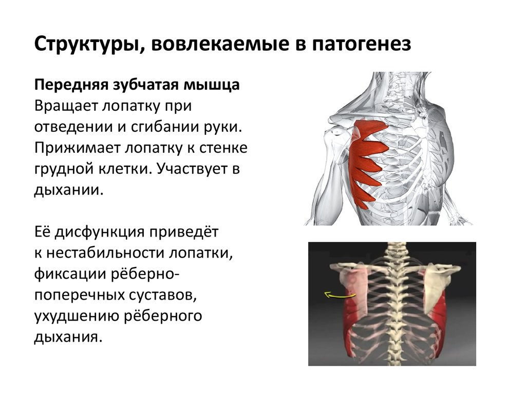 Плече лопаточная периартрит