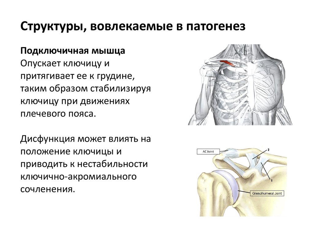 Периартрит плечевого