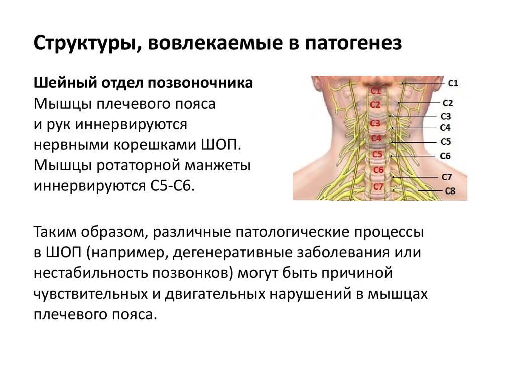 Плечелопаточный периартрит презентация