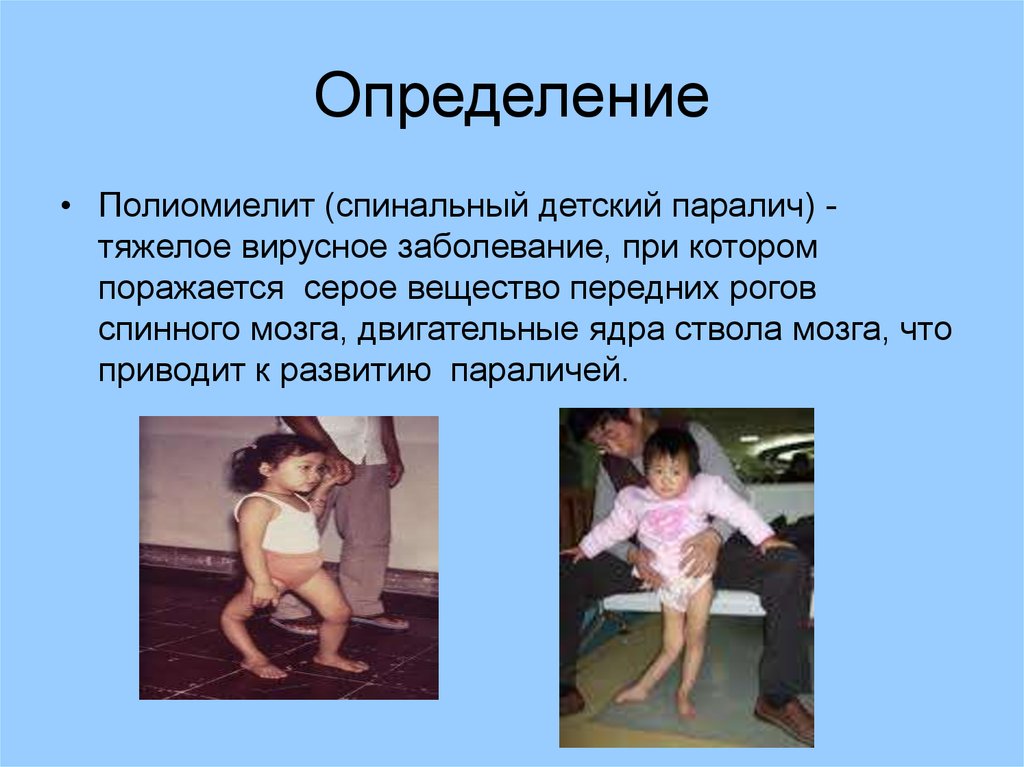 Определение