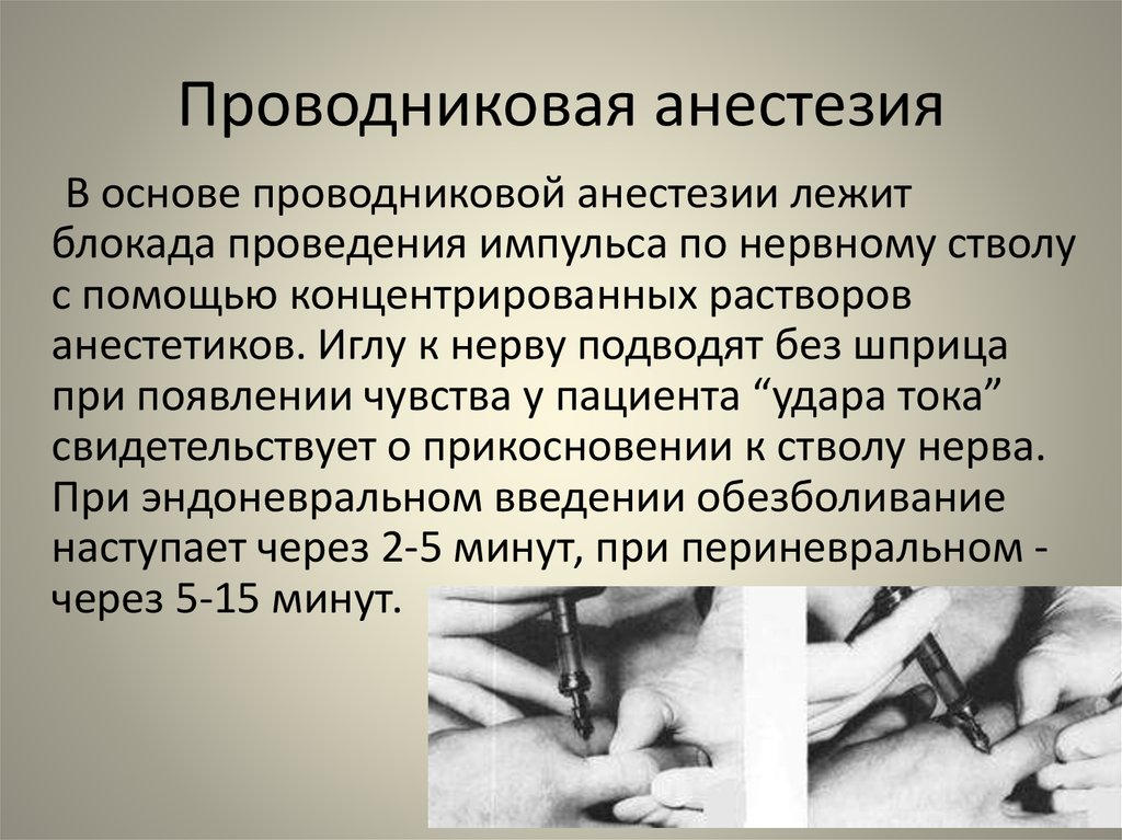 Анестезия анестезиология. Проводниковая анестезия. Проводниковаяанастезия. Методика проведения проводниковой анестезии. При проводниковой анестезии.