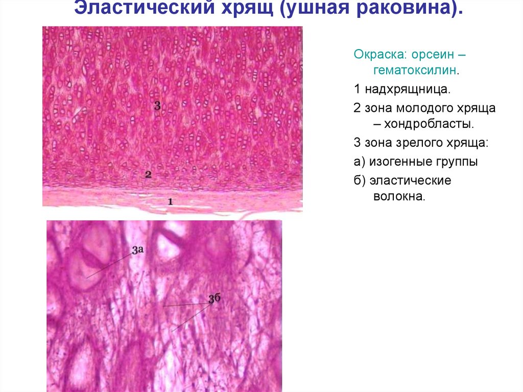 Прокол ушной раковины фото