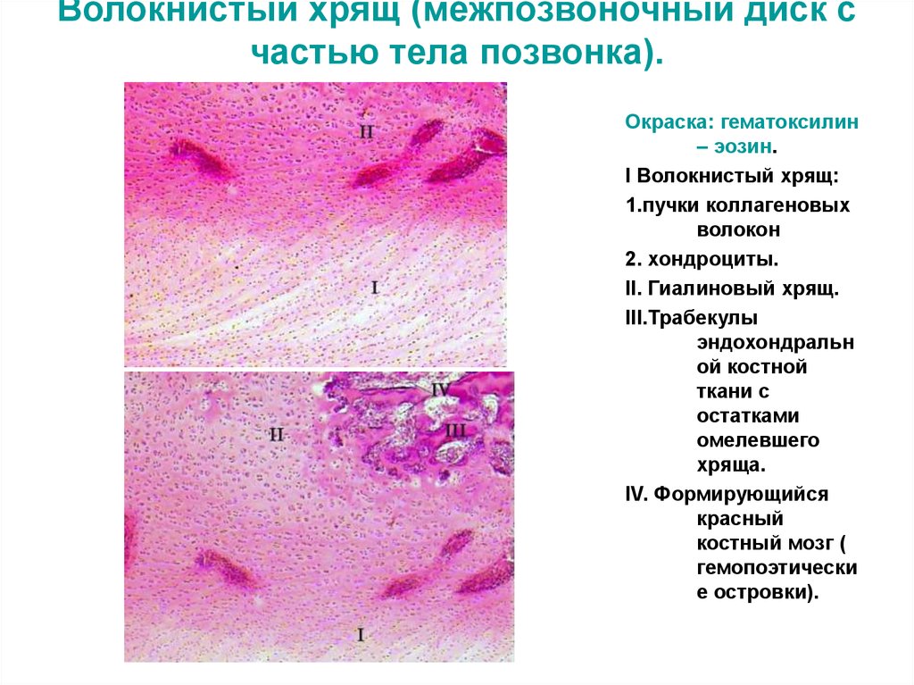 Волокнистый хрящ гистология рисунок