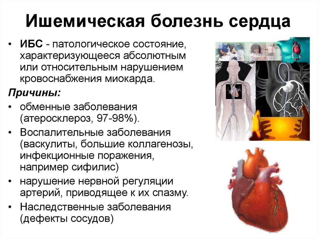 Ибс презентация по терапии