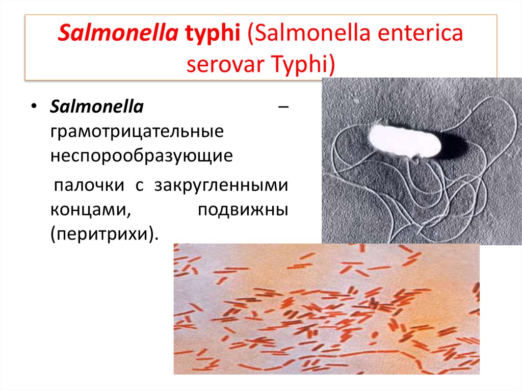 Сальмонеллез и брюшной тиф. Сальмонелла брюшного тифа бактерия. Вибрионы сальмонелла. Брюшной тиф возбудитель бактерия. Бактерии рода сальмонелла.