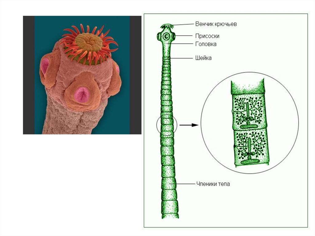 Сколексы цестод. Органы прикрепления паразитов. Органы прикрепления паразитов присоски. Органы прикрепления ленточных. Сколекс с присосками и крючьями.