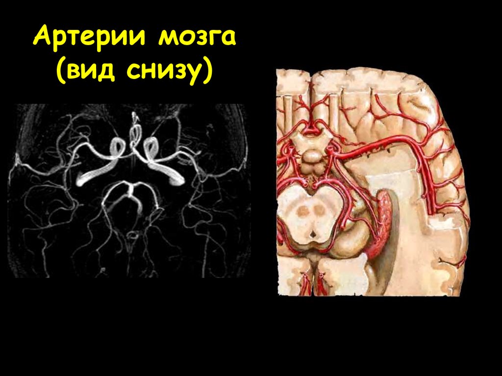 Артерии головного мозга картинка